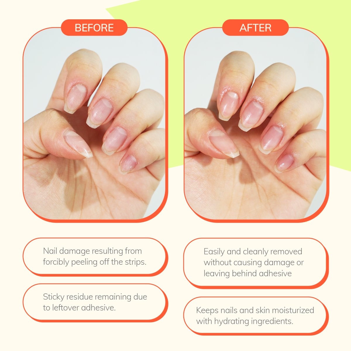 Remover & Top Gel Set (Free LED Lamp) - Heyhae - sun sured gel nail stickers